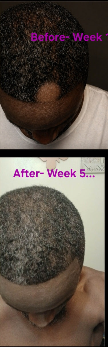 Hair Growth Serum