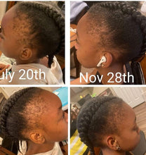 Load image into Gallery viewer, HAIR***Organic "Kids" Hair Growth Serum