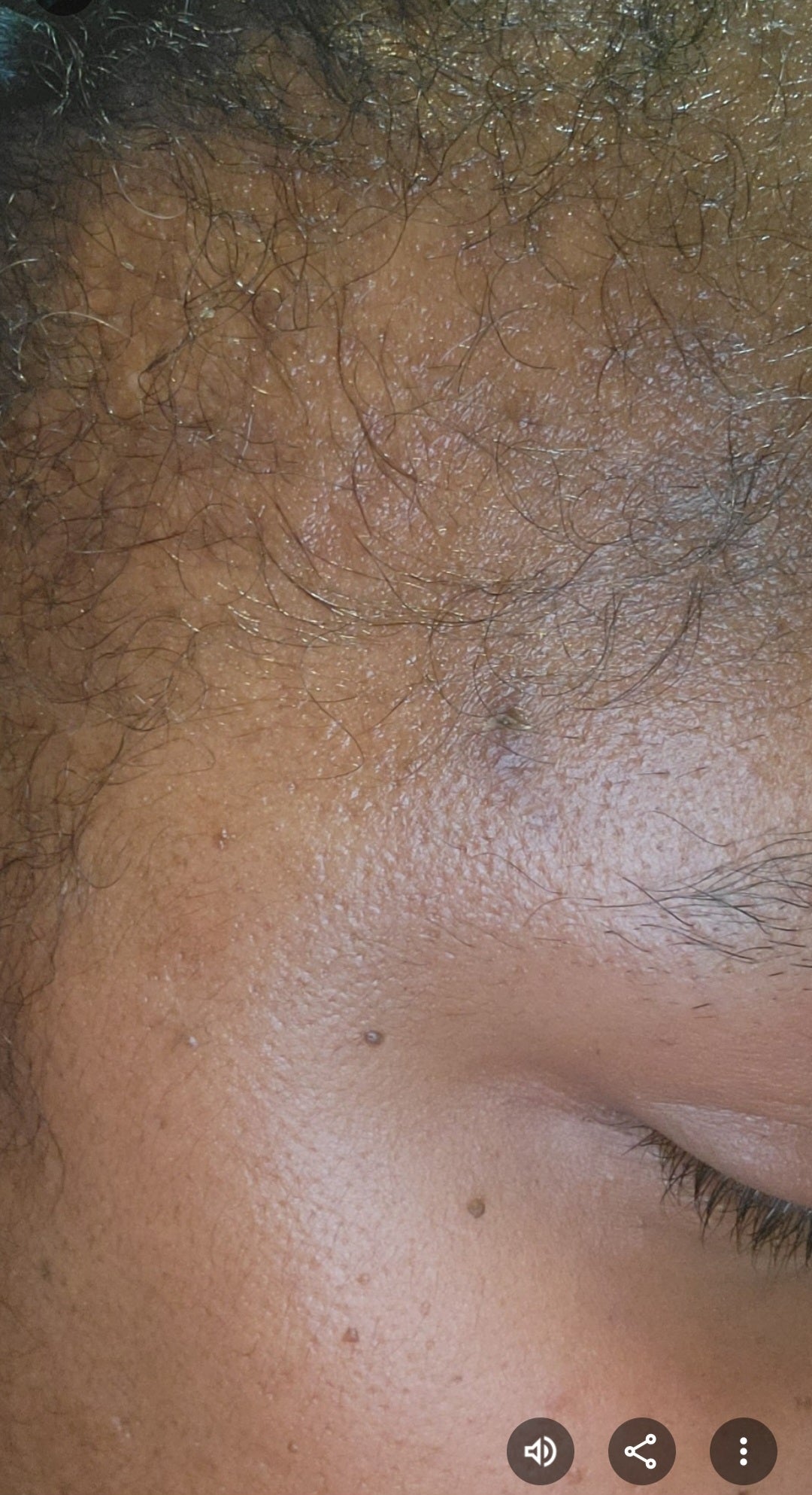 Hair**Edges Come Back Growth Serum-Roll On