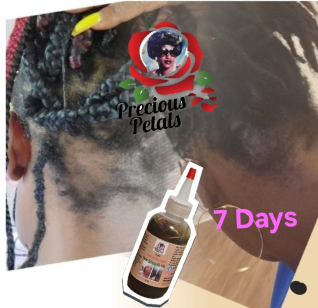 Hair Bundle- Root Stimulating Shampoo, Root Hydrating Conditioner, Hydrating Mist, & Hair Growth Serum